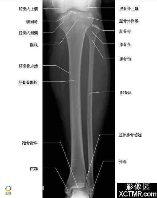 人的腿部骨骼结构图图片